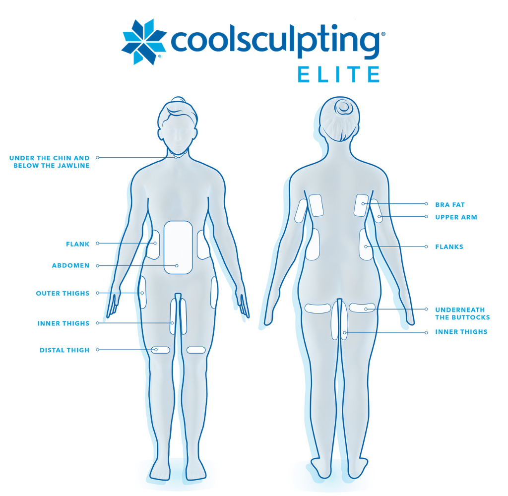 Euro Med Spa offers CoolSculpting fat-reduction treatments in Chattanooga and Cleveland, TN