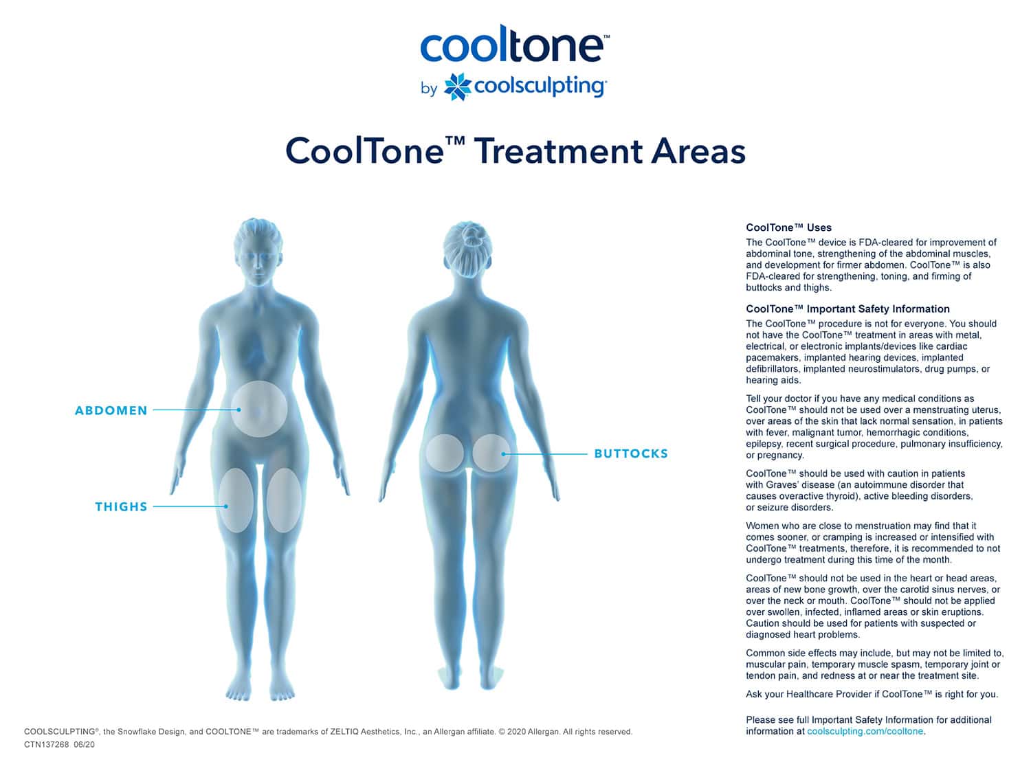 CoolTone treatment areas